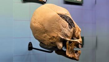 جمجمة بشرية