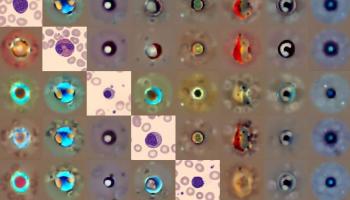 أنواع مختلفة من خلايا الدم حُللت باستخدام اسم آداة 