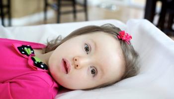 مرض إلكسندر، اضطراب وراثي يؤدي تدريجيًا إلى تدهور وظائف الدماغ