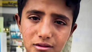 الطفل اليمني صقر