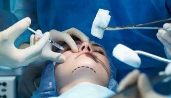 عملية تجميل - أرشيفية