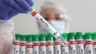 المكسيك تسجل أول حالة وفاة بسلالة  «H5N1» من إنفلونزا الطيور