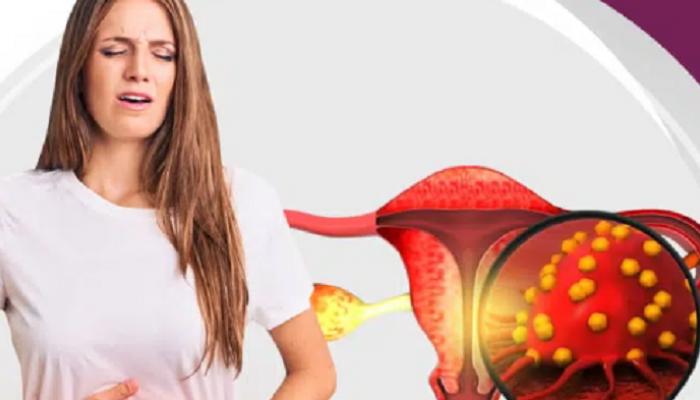 باحثون يحذرون من ارتفاع مقلق في معدلات الإصابة بسرطان الرحم
