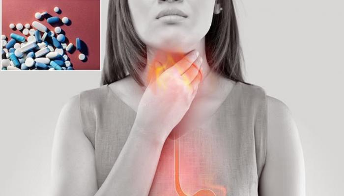 علاج حرقة المعدة الشائع قد يسبب الانتفاخ ونقص الفيتامينات