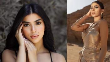 إصابة كارولين عزمي أثناء تصوير برنامج رامز جلال