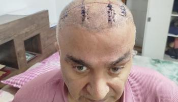 الكاتب الإيراني أحمد آصفي أحد ضحايا التعذيب