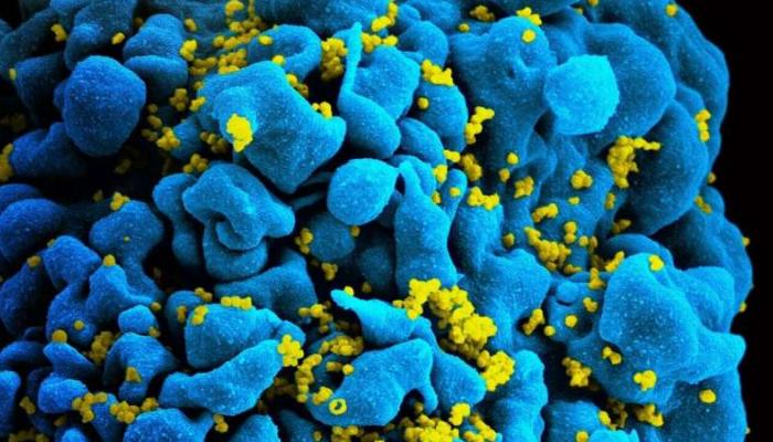 Hidden Factors Threatening the Lives of Women with HIV Beyond Antiviral Treatment