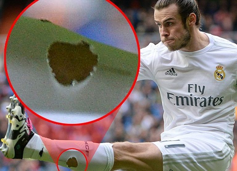 جاريث بيل يرتدي جوارب مشقوقة 