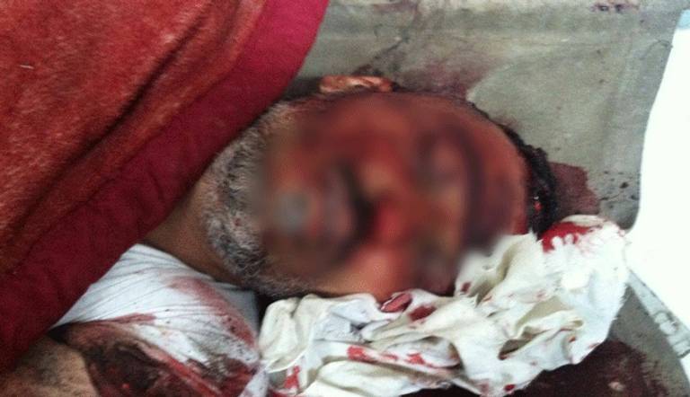 أحد المواطنين الذين اعدمتهما المليشيات رميا بالرصاص الجمعة