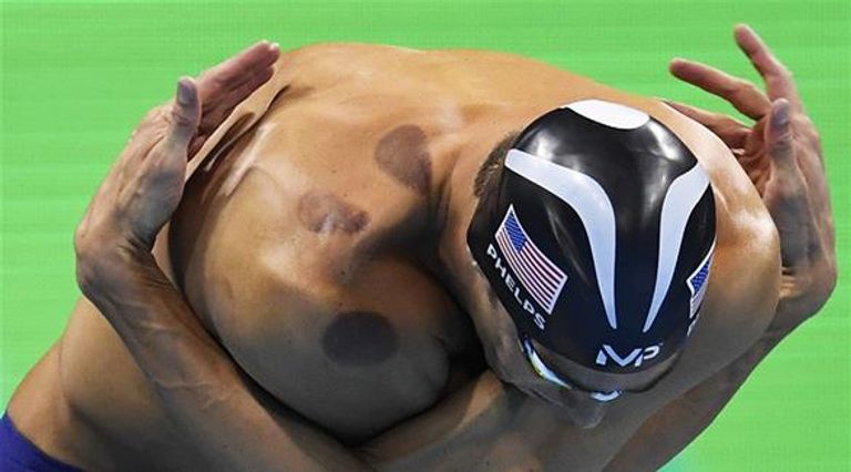 العلامات الحمراء على جسد فيلبس