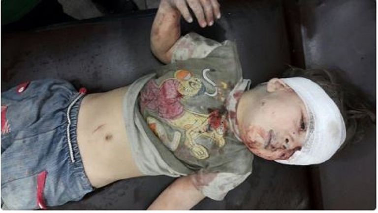 عمران أثناه تلقيه العلاج