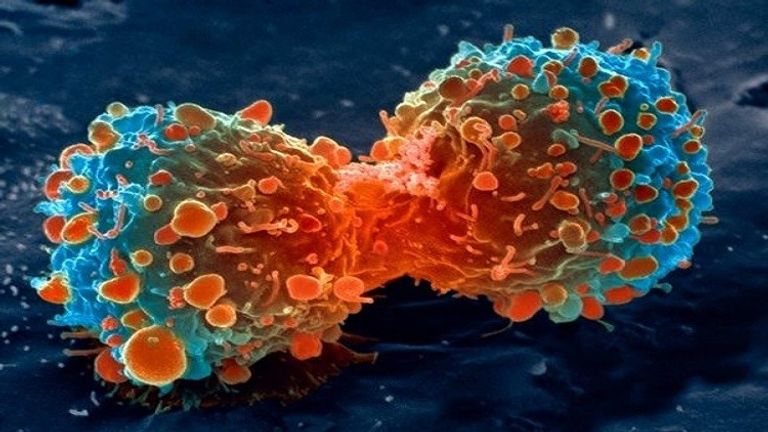 الخلايا السرطانية