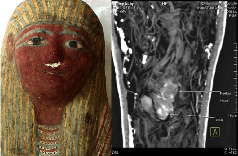  القائمون على متحف فيتزويليام كشفوا عن أصغر مومياء من مصر القديمة