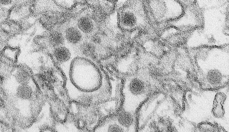 صورة مجهرية لفيروس زيكا وزعتها المراكز الأمريكية لمكافحة الامراض في اتلانتا بولاية جورجيا