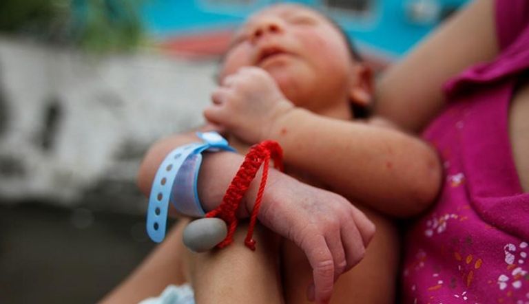 مولود في هندوراس مصاب بالميكروسيفالي أو صغر حجم الرأس للمواليد الذي يسببه فيروس زيكا