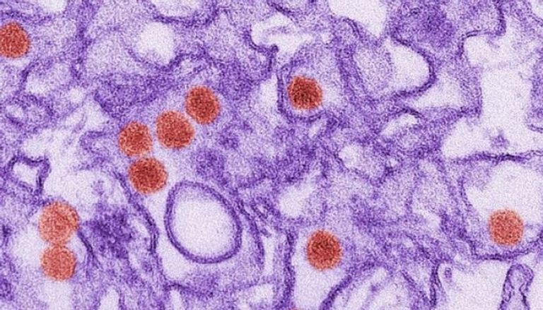 صورة مجهرية غير مؤرخة لفيروس زيكا من مراكز مكافحة الأمراض والوقاية منها