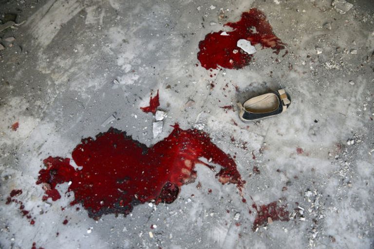 آثار قصف الحضانة بحرستا