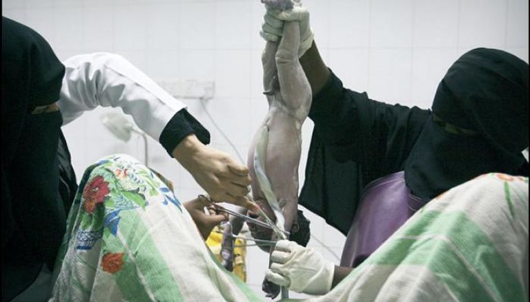 طبيبة سعودية خلال عملية توليد