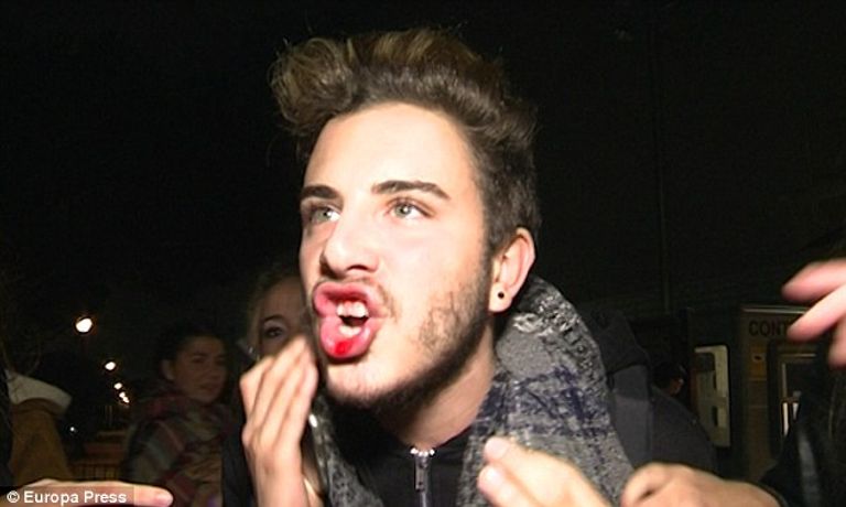 المعجب في حالة صدمة بعد إصابته