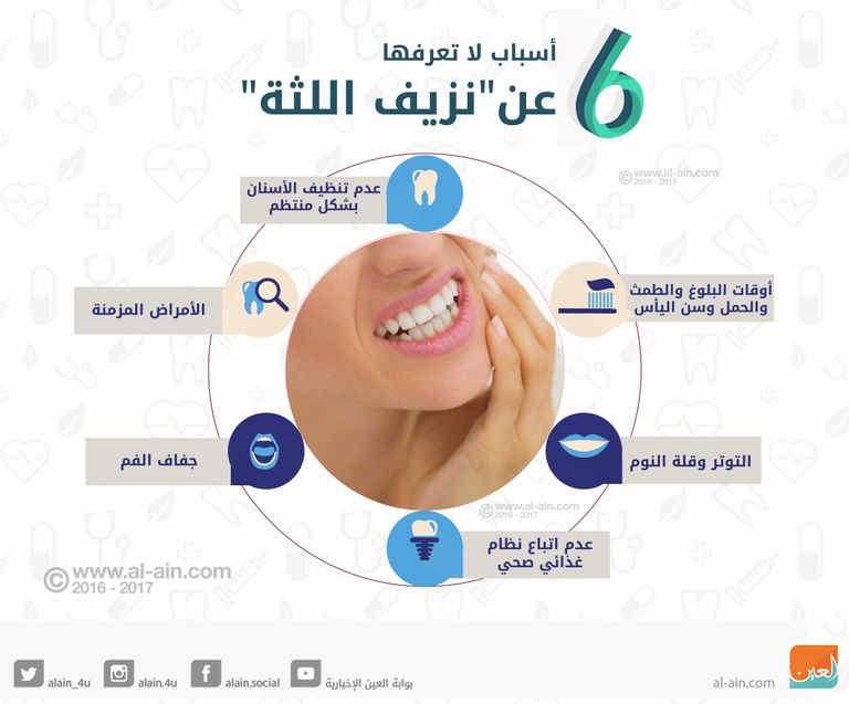 ماذا تعرف عن نزيف اللثة؟