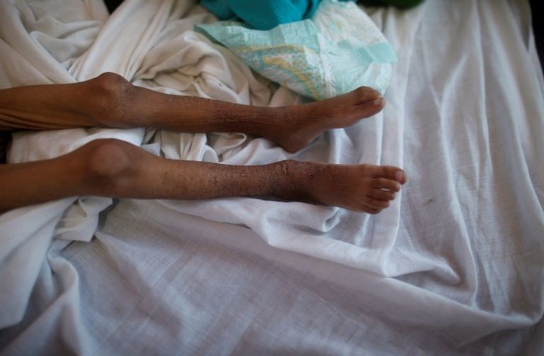 يمني يحمل طفله المريض