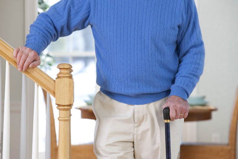 النعجة دوللي تعالج الشلل الرعاش