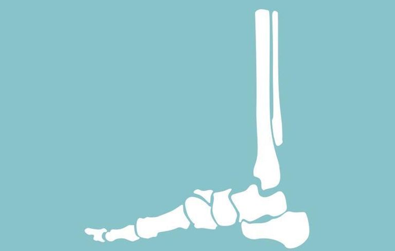 20% من وفيات سرطان الرئة لم يكونوا مدخنين