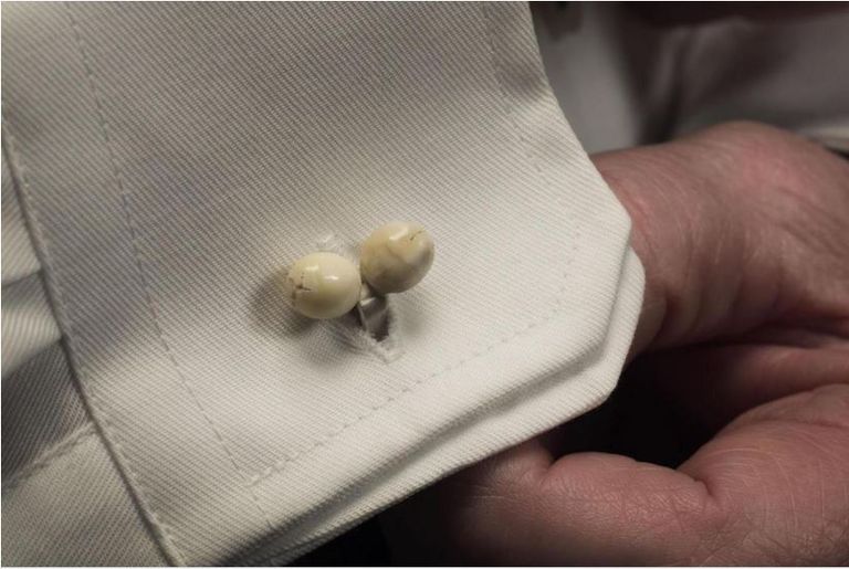 مجوهرات من أسنان البشر