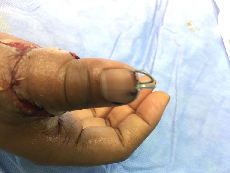 مركز الحوادث بمستشفى راشد بدبي