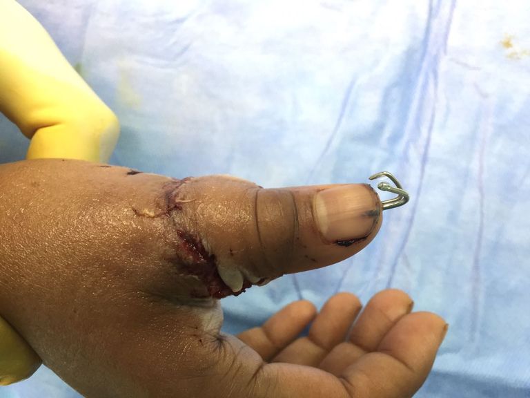 مركز الحوادث بمستشفى راشد بدبي