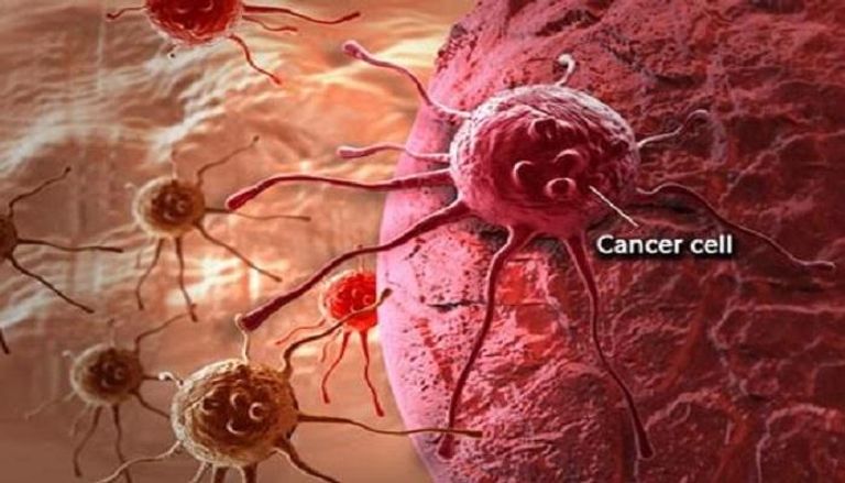 الجينات قادرة على منع انتشار السرطان بنسبة ٧٥%