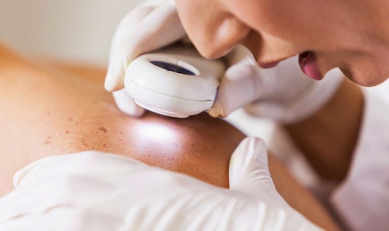 خلايا السرطان