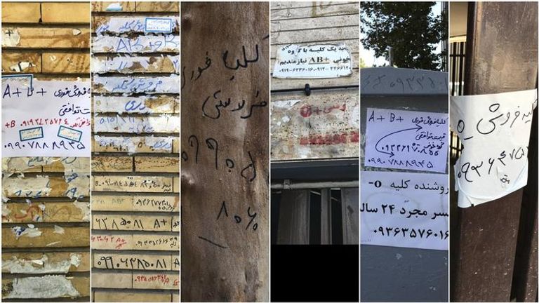 بيع الكلية مقابل 4600 دولار