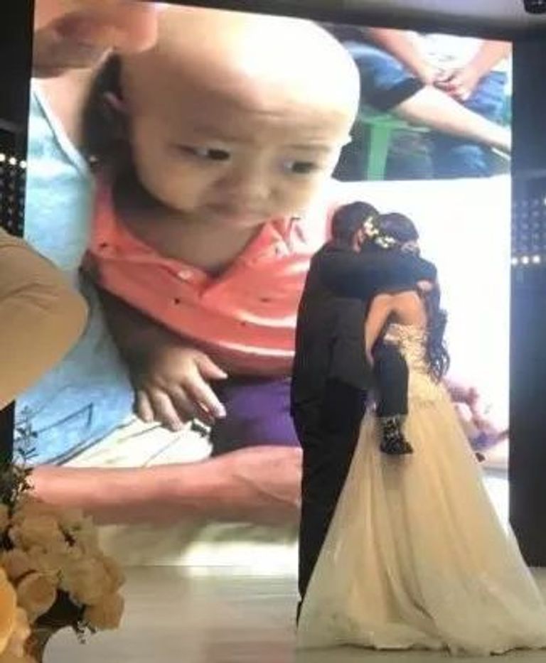 حفل زفاف لطفل مريض بالسرطان