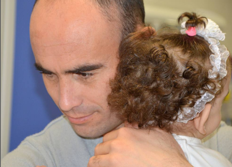 أطباء إيطاليون ينجحون في فصل توأم جزائري