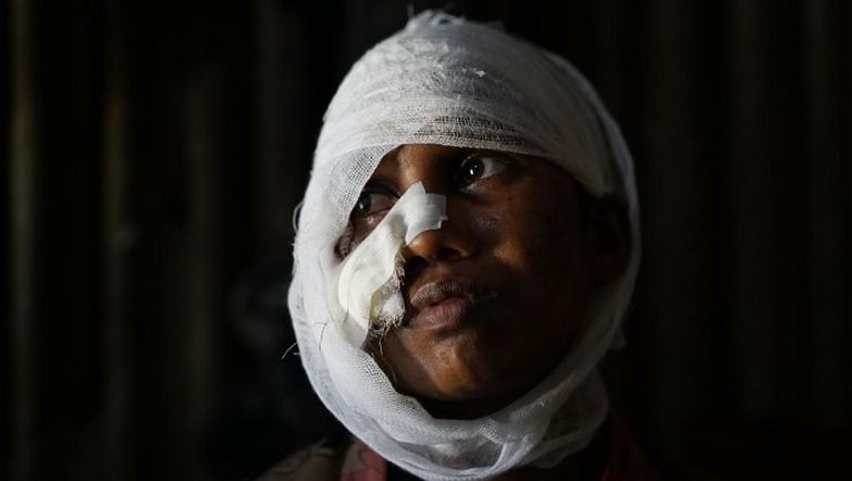 أزمة الروهينجا.. مأساة تتطلب تدخلا عاجلا