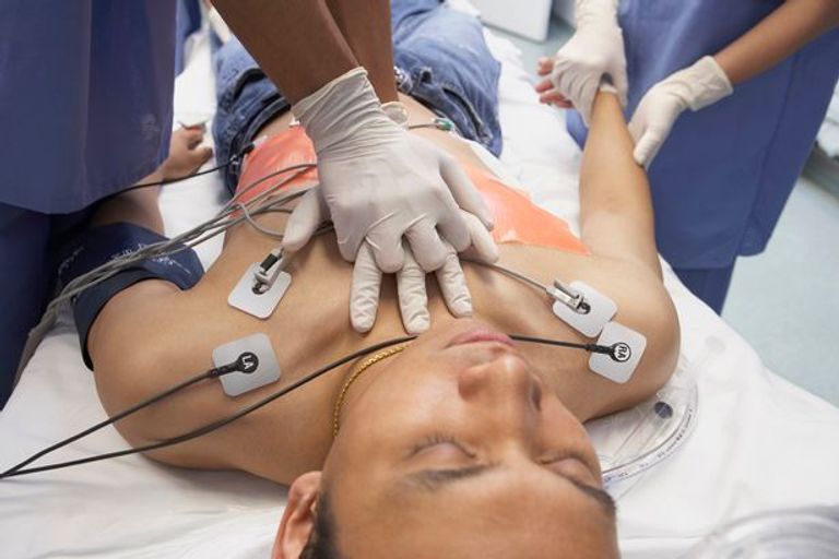 تنشيط القلب لمسنة - أرشيفية