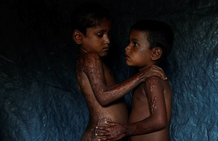 أزمة الروهينجا