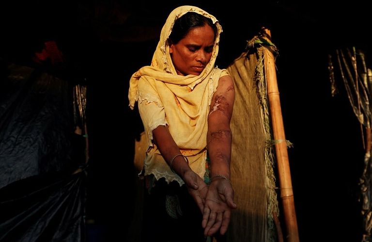 أزمة الروهينجا