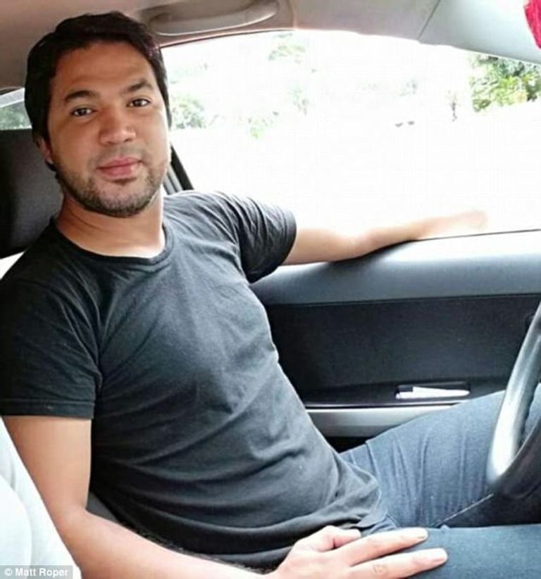 خضعت الزوجة لعمليات ترميمية في أنفها وشفتيها