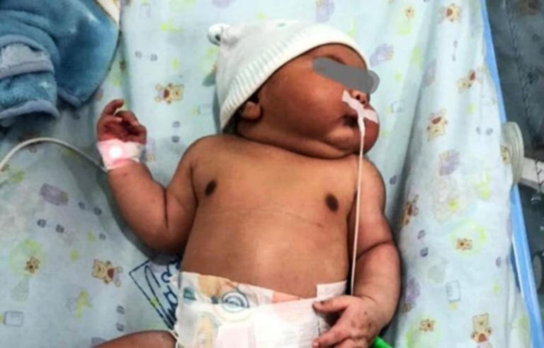 لم تتخيل الأم أن بطنها تحمل طفلا بهذا الحجم -أرشيفية