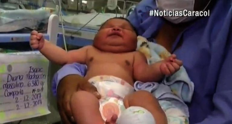 لم تتخيل الأم أن بطنها تحمل طفلا بهذا الحجم -أرشيفية