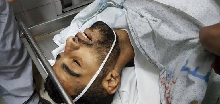صورة.. أول شهيد بانتفاضة القدس - صورة 2
