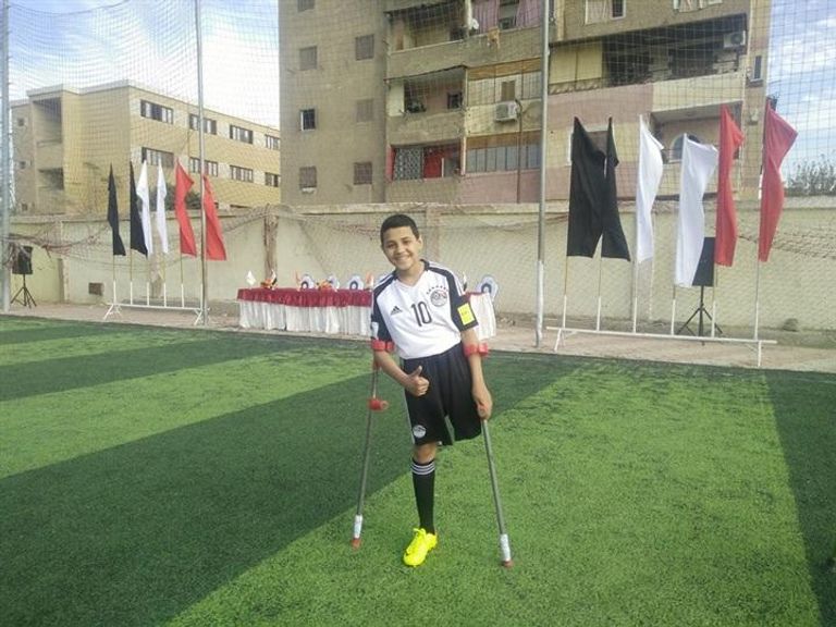 أحد أعضاء فريق "المعجزات" لأصحاب القدم الواحدة فريق "المعجزات" لأصحاب القدم الواحدة