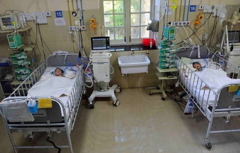 الطفلان بعد فصلهما