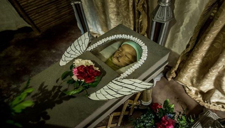 جثمان أحد أطفال فنزويلا قتله الجوع