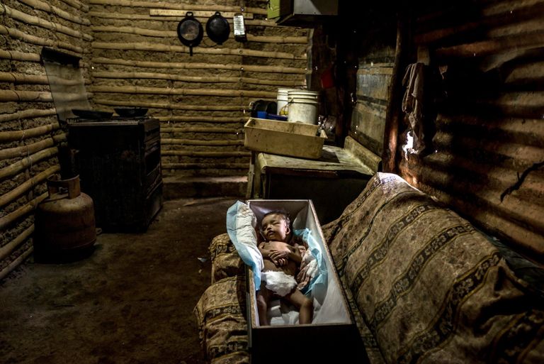 جثمان أحد أطفال فنزويلا قتله الجوع