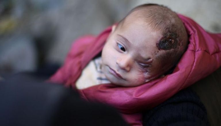 الرضيع السوري كريم أصبح رمزا للمقاومة
