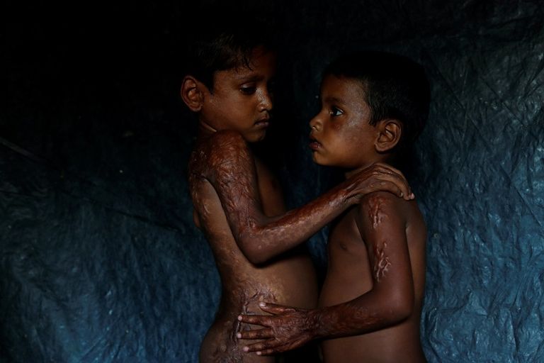 طفل من أقلية الروهينجا يبكي في مخيم اللجوء في بنجلاديش- رويترز