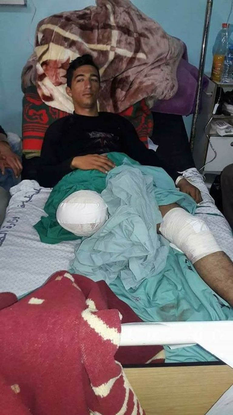 المصاب بسام أبو عنزة المصاب محمد أبو مصطفى